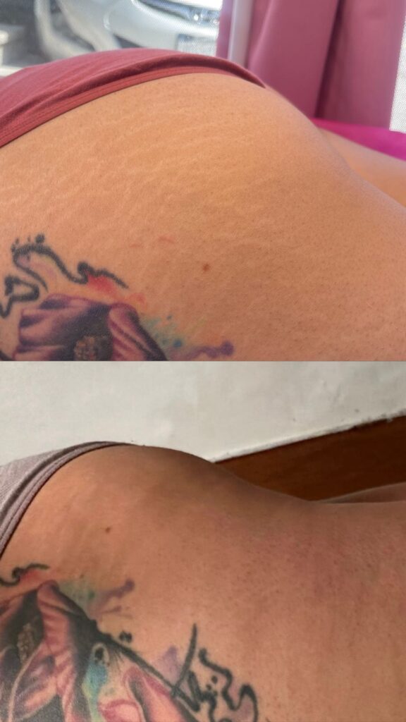 camuflaje sin pigmeento